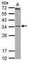 Junctional Adhesion Molecule 2 antibody, PA5-30788, Invitrogen Antibodies, Western Blot image 