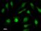 Insulin gene enhancer protein ISL-2 antibody, LS-C342702, Lifespan Biosciences, Immunofluorescence image 