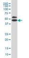 Rho GDP Dissociation Inhibitor Alpha antibody, H00002664-M08, Novus Biologicals, Western Blot image 