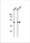 T-box transcription factor TBX6 antibody, TA324424, Origene, Western Blot image 
