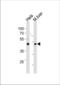 T-Box 6 antibody, TA324424, Origene, Western Blot image 