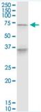 Proline, Glutamate And Leucine Rich Protein 1 antibody, H00027043-M01-100ug, Novus Biologicals, Western Blot image 