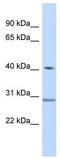 Zinc Finger Protein 396 antibody, TA345528, Origene, Western Blot image 
