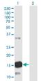 Ataxin 7 Like 1 antibody, H00222255-M06, Novus Biologicals, Western Blot image 