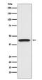 Cyclin Dependent Kinase 9 antibody, M00794, Boster Biological Technology, Western Blot image 