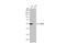 Atypical Chemokine Receptor 3 antibody, GTX100027, GeneTex, Western Blot image 