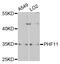 PHD Finger Protein 11 antibody, STJ24979, St John