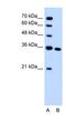 Solute Carrier Family 25 Member 29 antibody, NBP1-59499, Novus Biologicals, Western Blot image 