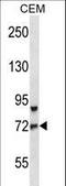Forkhead Box O3 antibody, LS-C166238, Lifespan Biosciences, Western Blot image 