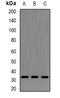 Leucine Zipper Tumor Suppressor Family Member 3 antibody, orb158208, Biorbyt, Western Blot image 