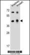 Adenosine Deaminase Like antibody, 57-162, ProSci, Western Blot image 