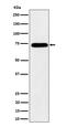 Heterogeneous Nuclear Ribonucleoprotein M antibody, M06017-1, Boster Biological Technology, Western Blot image 