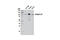 Integrin Subunit Beta 3 antibody, 13166S, Cell Signaling Technology, Western Blot image 