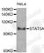 Signal transducer and activator of transcription 5A antibody, A7733, ABclonal Technology, Western Blot image 