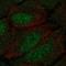 Doublecortin Like Kinase 1 antibody, HPA015040, Atlas Antibodies, Immunocytochemistry image 