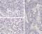 Interleukin 1 Beta antibody, GTX22105, GeneTex, Immunohistochemistry paraffin image 