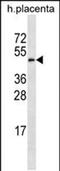 Galactose-3-O-Sulfotransferase 4 antibody, PA5-48490, Invitrogen Antibodies, Western Blot image 