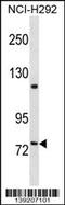 Fermitin Family Member 2 antibody, 60-238, ProSci, Western Blot image 