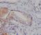 TSC Complex Subunit 2 antibody, M00229, Boster Biological Technology, Immunohistochemistry paraffin image 