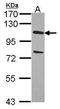 Ubiquitin Specific Peptidase 28 antibody, GTX104646, GeneTex, Western Blot image 