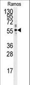 Protein Tyrosine Phosphatase Non-Receptor Type 1 antibody, LS-C100986, Lifespan Biosciences, Western Blot image 