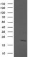 Anaphase Promoting Complex Subunit 11 antibody, NBP2-45493, Novus Biologicals, Western Blot image 