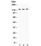 Exportin 1 antibody, R32412, NSJ Bioreagents, Western Blot image 