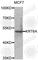 Keratin 6A antibody, A7560, ABclonal Technology, Western Blot image 