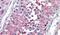 Protein Kinase C Zeta antibody, PA5-32989, Invitrogen Antibodies, Immunohistochemistry paraffin image 