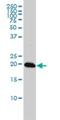 Centromere Protein M antibody, H00079019-M01, Novus Biologicals, Western Blot image 