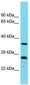 Tyrosine-protein phosphatase non-receptor type 20 antibody, TA335960, Origene, Western Blot image 