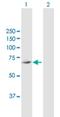 Acyl-CoA Synthetase Short Chain Family Member 3 antibody, H00079611-B01P, Novus Biologicals, Western Blot image 