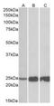 Troponin I2, Fast Skeletal Type antibody, orb106869, Biorbyt, Western Blot image 