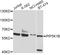 Phosphatidylinositol-4-Phosphate 5-Kinase Type 1 Beta antibody, A4215, ABclonal Technology, Western Blot image 