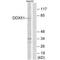 DEAD-Box Helicase 51 antibody, A11206, Boster Biological Technology, Western Blot image 