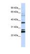 Transmembrane Protein 255A antibody, NBP1-59972, Novus Biologicals, Western Blot image 