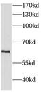 Hexosaminidase Subunit Alpha antibody, FNab03843, FineTest, Western Blot image 