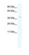 TATA-Box Binding Protein Associated Factor 7 Like antibody, orb329945, Biorbyt, Western Blot image 