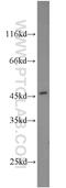 PARP2 antibody, 55149-1-AP, Proteintech Group, Western Blot image 