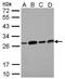 Enoyl-CoA Hydratase, Short Chain 1 antibody, GTX114375, GeneTex, Western Blot image 