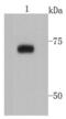 Protein Arginine Methyltransferase 5 antibody, NBP2-67075, Novus Biologicals, Western Blot image 