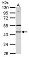 RN133 antibody, NBP2-20176, Novus Biologicals, Western Blot image 
