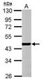 Actin Alpha Cardiac Muscle 1 antibody, GTX101900, GeneTex, Western Blot image 