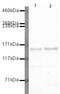 GLI Family Zinc Finger 3 antibody, PA5-19822, Invitrogen Antibodies, Western Blot image 