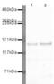 GLI Family Zinc Finger 3 antibody, PA5-19822, Invitrogen Antibodies, Western Blot image 