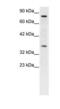 Neuronal PAS Domain Protein 1 antibody, PA1-24403, Invitrogen Antibodies, Western Blot image 