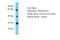 Chondroitin Sulfate N-Acetylgalactosaminyltransferase 2 antibody, A10939, Boster Biological Technology, Western Blot image 