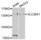 Elastin Microfibril Interfacer 1 antibody, STJ23534, St John