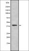 Transmembrane Protein With EGF Like And Two Follistatin Like Domains 2 antibody, orb337248, Biorbyt, Western Blot image 