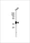 Nucleophosmin 1 antibody, GTX81996, GeneTex, Western Blot image 